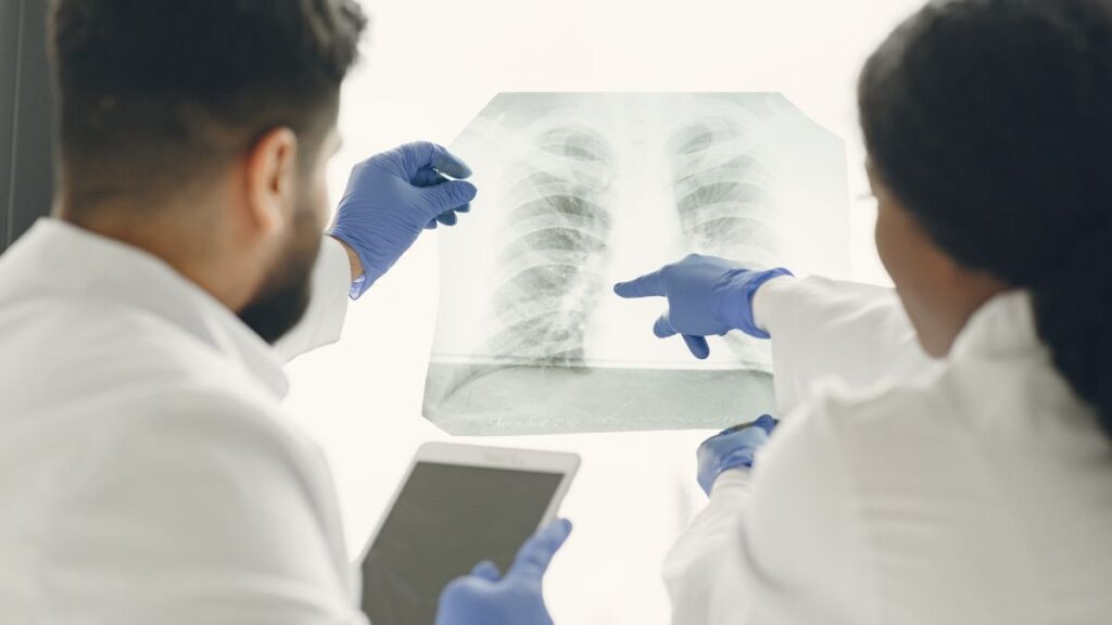 Lung Cancer Diagnosis & Treatment