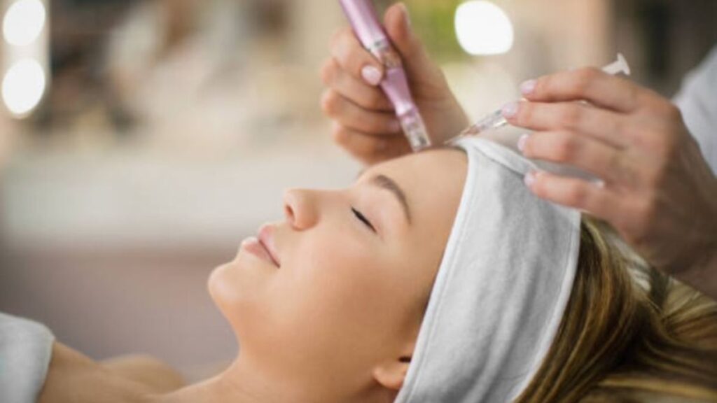 SkinPen Microneedling