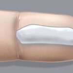 Betametacron vs. Other Corticosteroids: What You Need to Know